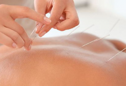 埋线减肥视频全过程,埋线减肥全过程揭秘